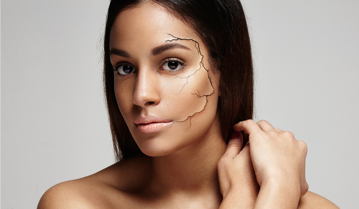 Piel deshidratada, síntomas y tratamiento