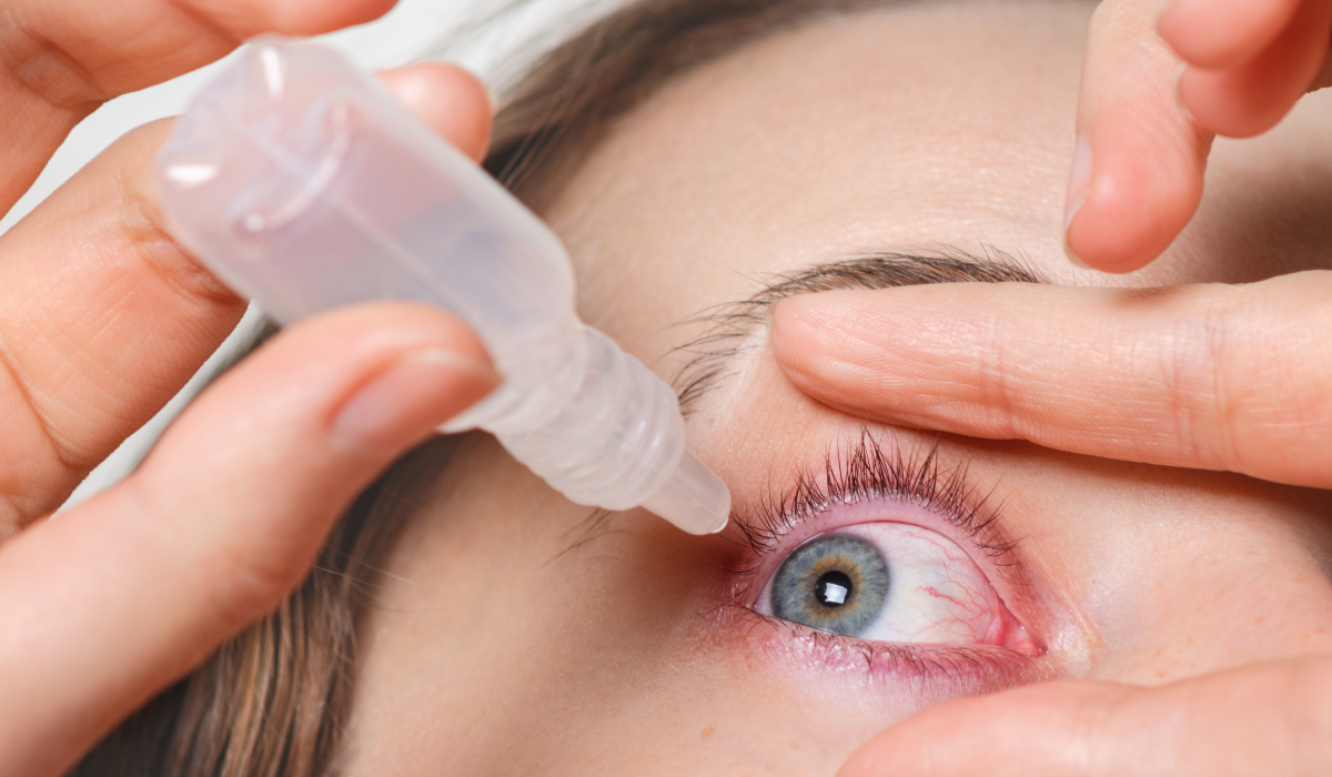 Conjuntivitis: causas, síntomas y tratamiento